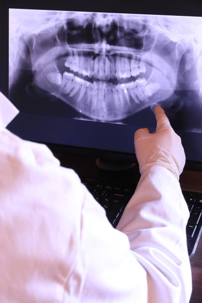 Best Broken or Chipped Tooth Repair in Maggie Valley, NC