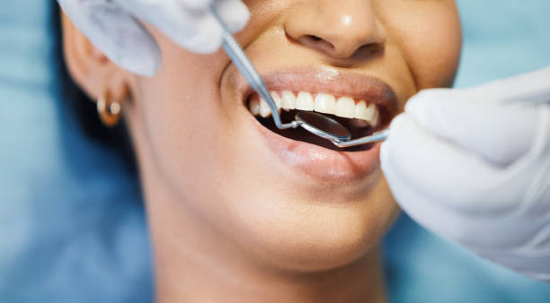Best Emergency Wisdom Tooth Extraction in Maggie Valley, NC